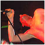 Twisted Nerve